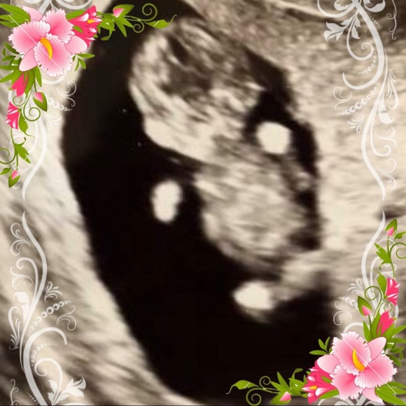 Meet your Posher, Joyce - Picture 1 of 1